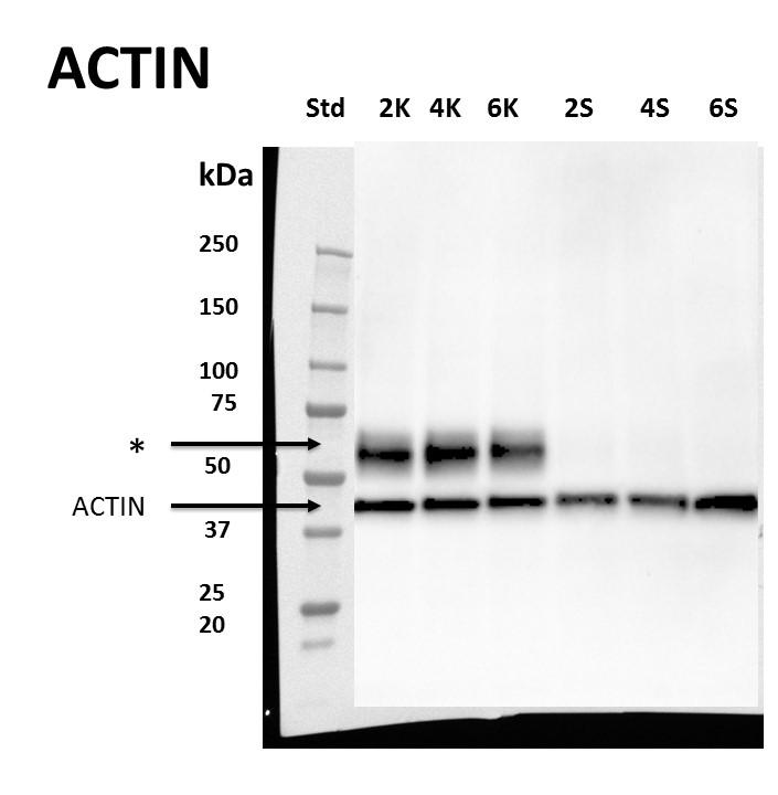 Obrázek 12. Imunodetekce C- MYC proteinu.