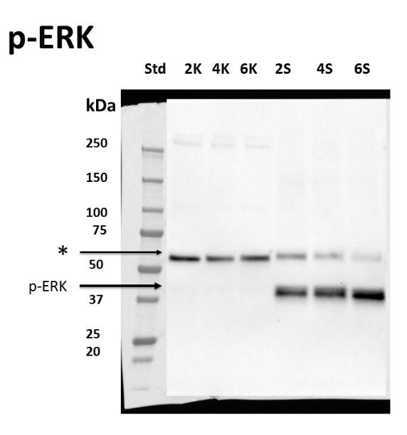 Obrázek 15. Imunodetekce kinasy p-erk. Imunodetekce p-erk po přidání 2 µm shikoninu zpracovaná v časovém intervalu 2hod, 4hod, 6hod a v jednotlivých kontrolních vzorkách bez přídavku shikoninu.