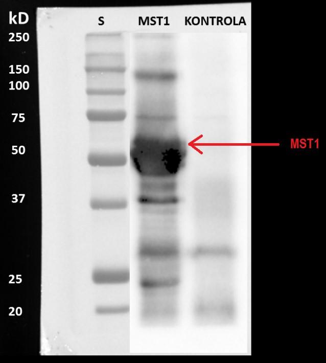 Obrázek 16. Imunodetekce MST1 kinasy. Vzorky získané imunoprecipitací přes Protein PLUS G-Agarosu. V oblasti 60 kda je viditelný slabý fragment MST1 kinasy.