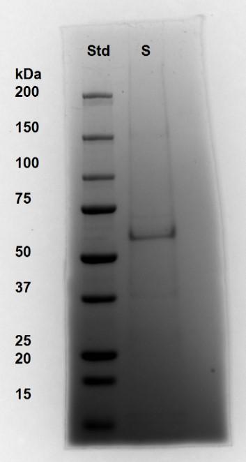 4 Výsledky imunoprecipitace přes magnetické kuličky Kvůli nízké účinnosti metody precipitace MST1 kinasy přes Protein PULS G- Agarosu jsme se rozhodli použít jinou metodu, imunoprecipitaci přes