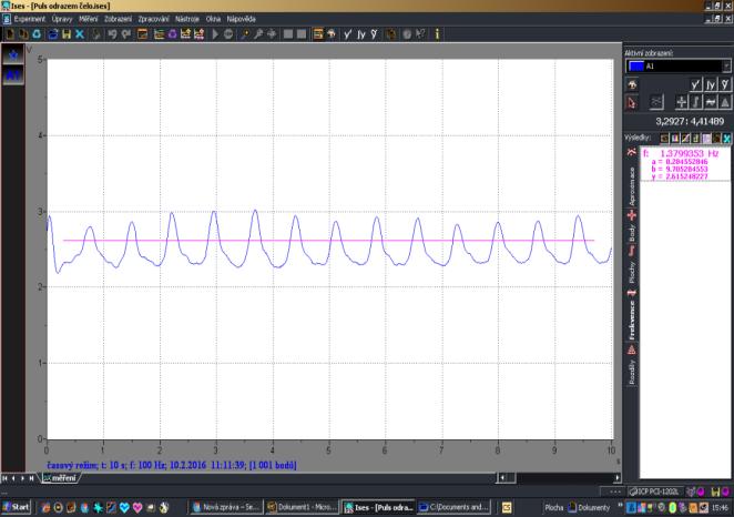 19. Pulsová vlna z čela - Palencefalogram (autor) Měření pulsních periferních vln prstovým pulsním oxymetrem (Obr.20-23) Pulsní vlna se také měří prstovým pulsním oxymetrem (obr.