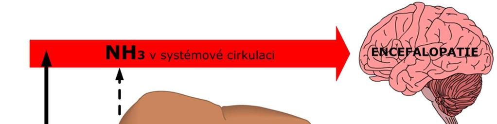 peritonitida 4) hepatorenální syndrom Jícnové varixy 42 Jaterní encefalopatie porucha vědomí (kvantitativní i kvalitativní), chování a