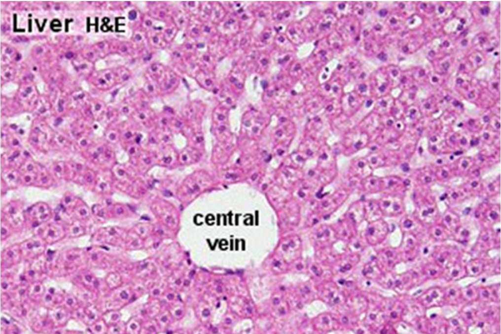 Hepatocyty, jaterní sinusoidy NEMOCI A POŠKOZENÍ JATER 21 22 Etiologie poškození jater