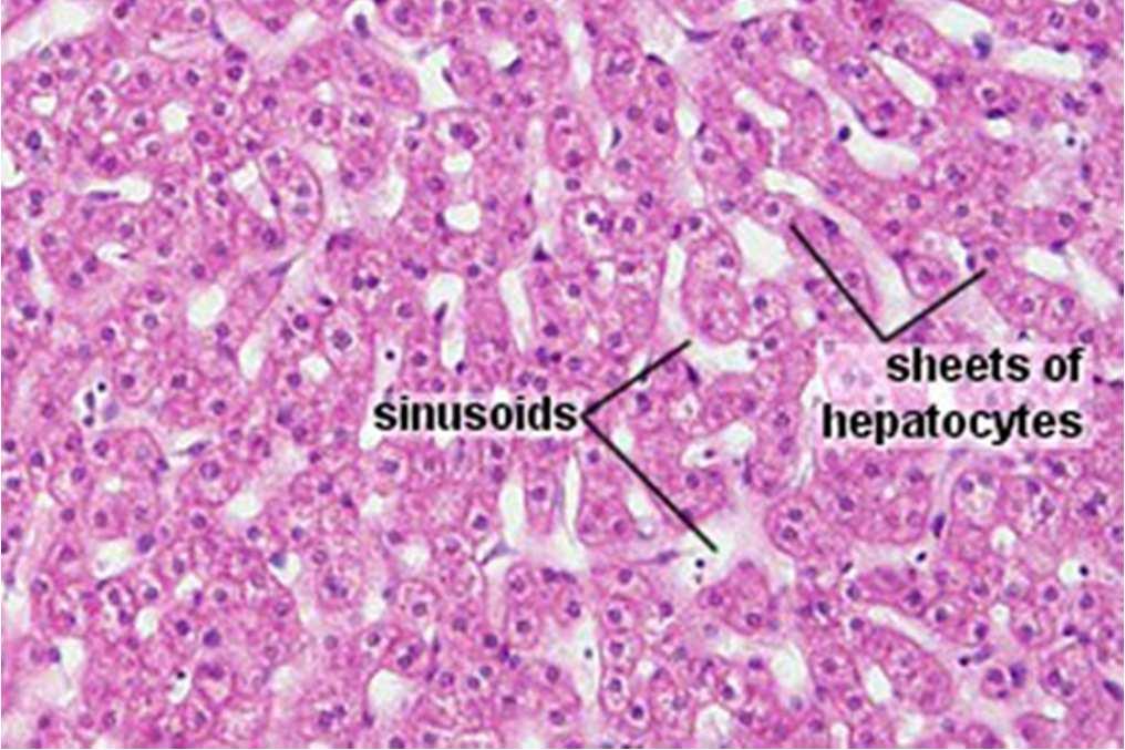 HAV, HBV, HCV) vyhojení bez následků inf.