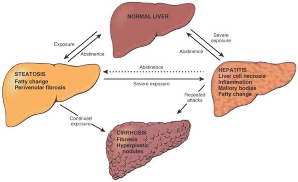 podíl tuku (TAG) v hepatocytech <5% histologicky malokapénková nebo velkokapénková příčiny nadměrný