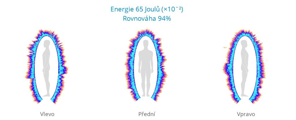 Plucnar Jiří 2018-12-05 13:08:46 Lidské Energetické Pole je nejcitlivějším odrazem fyzického, emočního, a v některých případech spirituálního stavu člověka.