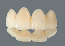 informace o materiálech Provizorní kompletní náhrada u mladého pacienta s Dentinogenesis imperfecta pomocí korunek VITA CAD-Temp pro estetickou a funkční rehabilitaci a korekturu vertikálního rozměru