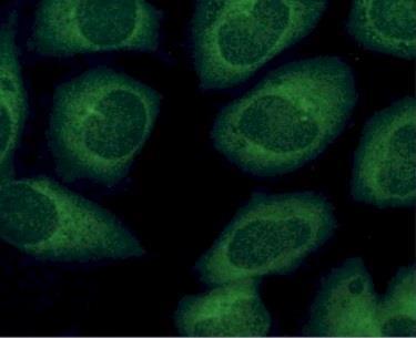 které mohou být vymyty z jader užitím neutrálního roztoku pufru (RNP, sm antigen, trna