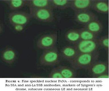 SS-A, SS-B, RNP, sm, Jo-1, scl-70, centromery ANA - jemně zrnitá fluorescence jader ANA-