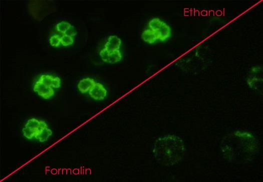 ZRNITÁ FLUORESCENCE CYTOPLAZMY ETANOLEM FIXOVANÝCH GRANULOCYTŮ, VE FORMALÍNU FIXOVANÝCH GRANULOCYTECH PONĚKUD HRUBŠÍ ZRNITÁ FLUORESCENCE CYTOPLAZMY HOMOGENNÍ