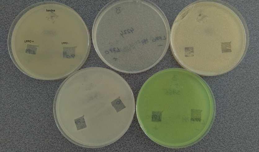 Enterococcus fecalisccm 4224 Staphylococc usaureus CCM 3953 Escherichia coli CCM 3954 Pseudomonas aeruginosa CMM 3955 Candida albicans Inhibiční zóna (mm) LPPO - LPPO + bavlna