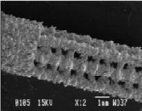 APLIKACE METOD RP PŘI VÝROBĚ IMPLANTÁTŮ Obr. 2.9 Růst kosti do implantátu [6]. 2.2.2 Biokompatibilita implantátů V oblasti medicíny se pro výrobu implantátů nejčastěji používají dva biokompatibilní materiály Ti-6Al-4V a Co-Cr-Mo.