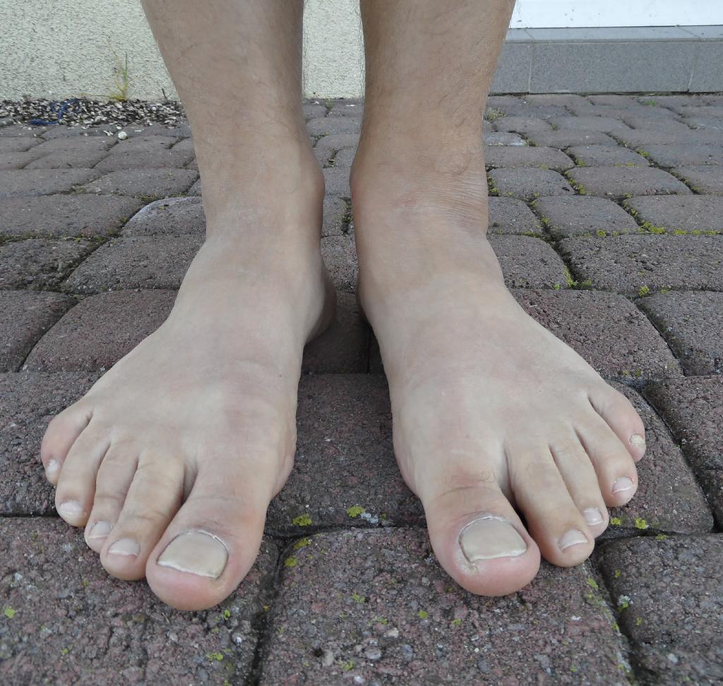 INTRODUCTION According to the observation of all our cases in Out-Patients Clinics and in our Orthopedics Departments, the main reason for musculoskeletal disorders, deformations and pains originates