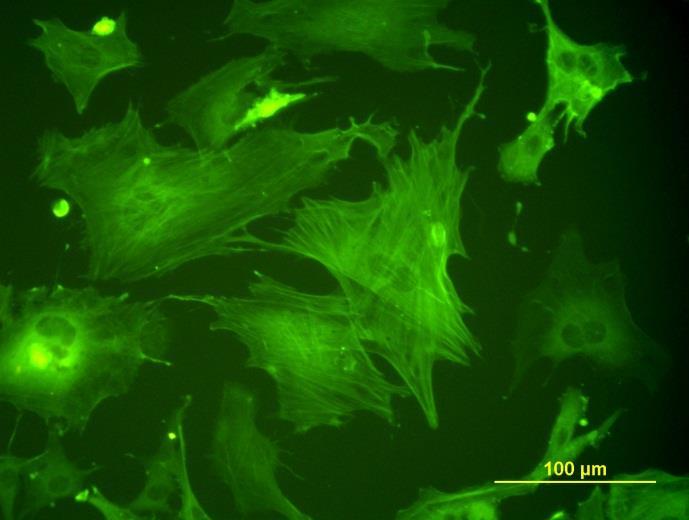 I_Heparin_Co IV_Laminin