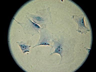 Cells/cm 2 (x1000) Smáčivost, povrchová energie,