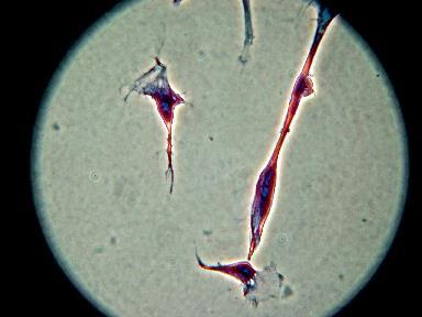 PLLA PEO_18 PEO_10 G, PLLA COOH_40 G, PLLA, 33, 18,