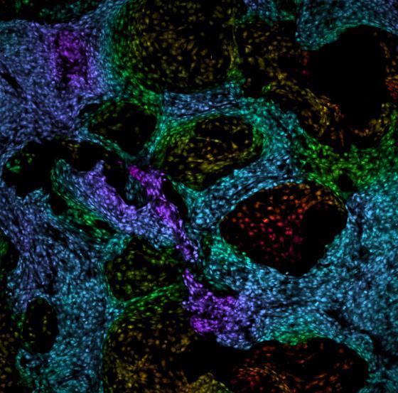 nasazení Póry 40 µm, hloubka 60