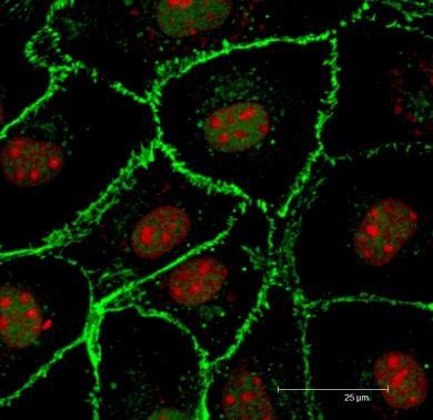 VE-cadherin V endotelových buňkách na fibrinu Rodina cadherinových receptorů Kalcium-dependentní homotypická adheze buňka-buňka N-, P-, R-,B- a E-cadheriny a asi 10 dalších členů.