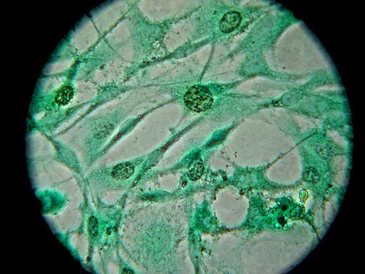 Medium without growth factors