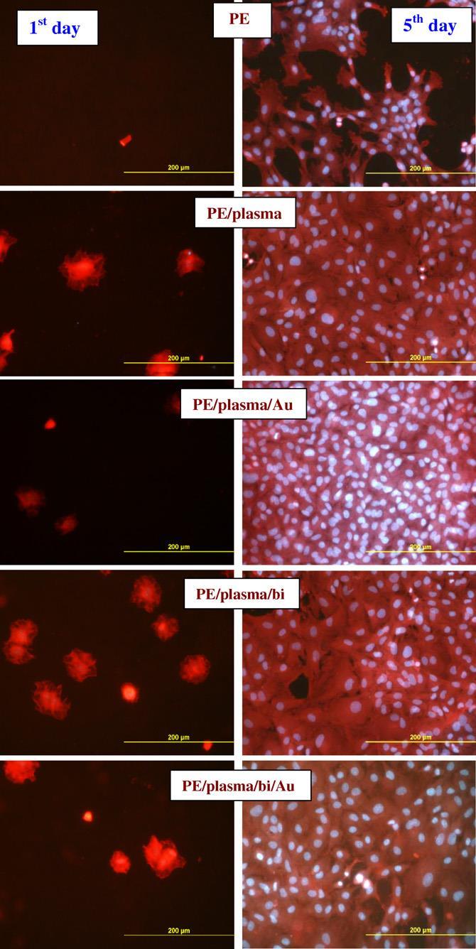 272 (2012) 391 395 PE- plasma