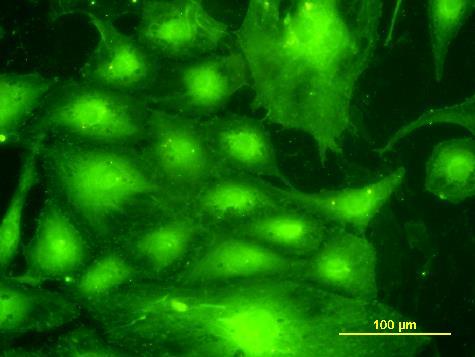 alpha V -integrin, EC, 3.