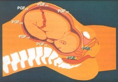 Obrázek 3 Rozlo ení prostaglandinových receptor (ROZTO IL, A. et al., 1997. Prostaglandiny v porodnictví. Velké N m ice: Z.Frömmel, 128s. ISBN 80-902344-0-2.