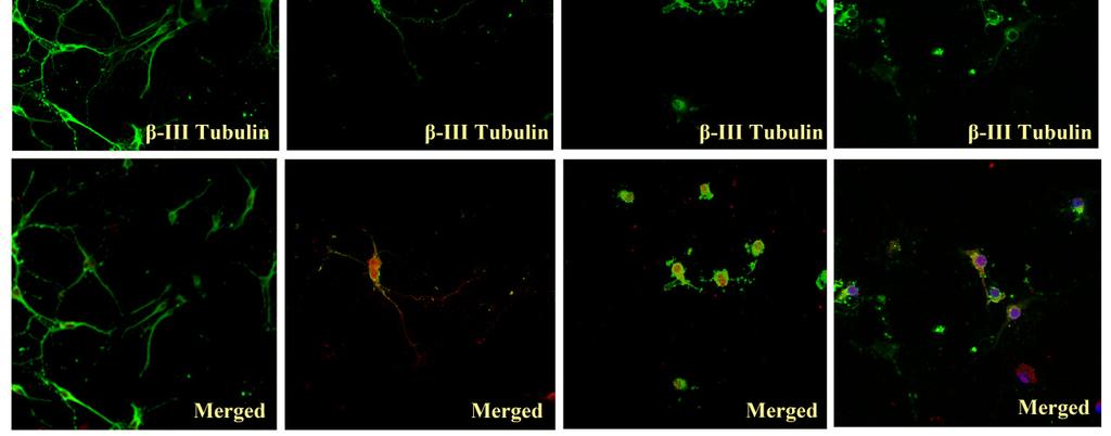 Cyclin B1 localization was both nuclear and cytoplasmic when treated with 4µM juglone for 3 hours (Figure 3.6). Still, cyclin B1 was localized in the nucleus rather than the cytoplasm.