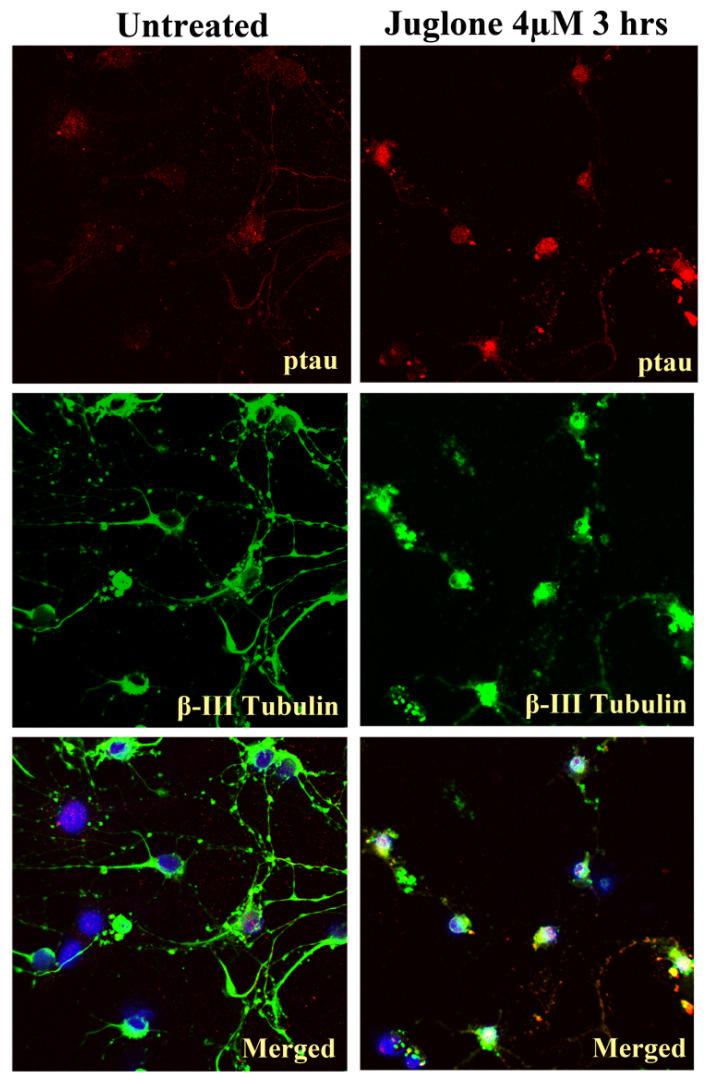 A B Ptau Expression Integrated Pixel Analysis 300000 250000 200000 150000 100000 50000 0 1 untreated ptau 4 jug 3 hrs Figure 3.