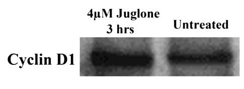 3.3. Western Blotting and Immunohistochemistry (IHC) Analyses In order to confirm the immunocytochemistry and real time PCR results Western Blotting analysis was performed.