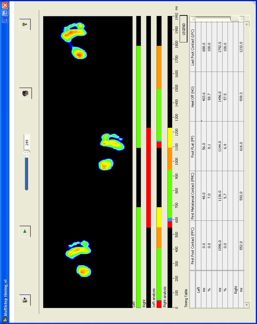 58 5.9 Analýza krokového cyklu Po zmáčknutí tlačítka (Timing) v obrazovce rozdělení otisku do 10 oblastí (viz 5.3) se zobrazí obrazovka analýzy krokového cyklu.