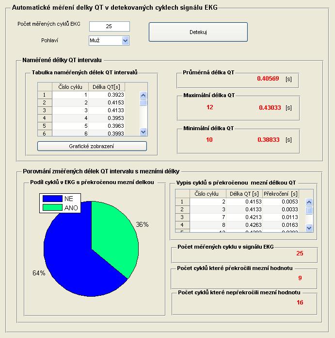 Obrázek 9.42:Blok Automatické měření délky QT v detekovaných cyklech signálu EKG Pro lepší přehlednost si výsledky detekce může uživatel zobrazit graficky (obrázek 9.