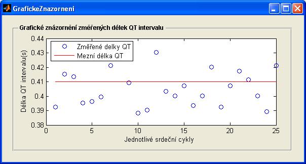 43:Grafické znázornění výsledných délek QT Aby mohl uživatel prověřit správnost měření popřípadě si jen zobrazit detekci příslušného srdečního cyklu, který překročil mezní délku, musí přejit k