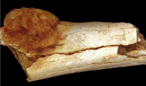 Homo ergaster nebo Paranthropus