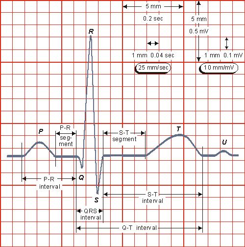 Typický elektrokardiogram Principy EKG P počátek kontrakce a stahy síní P-R zpoždění na AV uzlu QRS