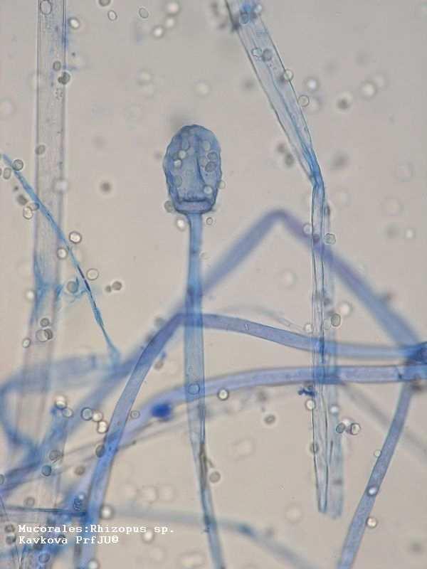 Phylum: Glomeromycota
