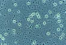 traktu, množí se Zažívací ústrojí se zbarvuje doběla, průjmové symptomy dehydratace, plouživé chování včel Šíří se
