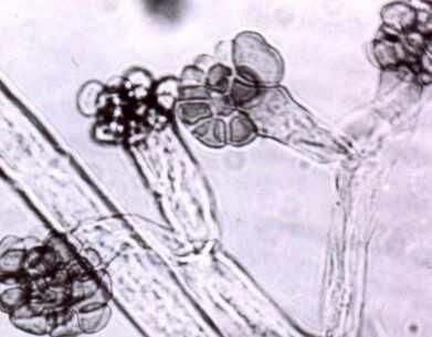 Syzigites