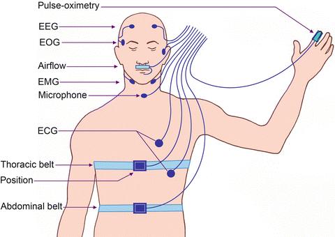 Polysomnografie EEG pro určení spánkového