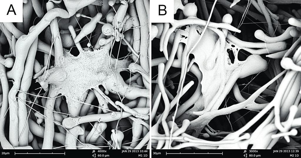 TROMBOCYTOVÉ RŮSTOVÉ FAKTORY, PROLIFERACE FIBROBLASTŮ, NANOVLÁKNA Obr. 4 L idské dermální fibroblasty po jednodenní kultivaci na PCL nanovlákenné vrstvě (a) a na vrstvě modifikované trombocyty (b).