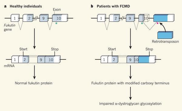 Poruchy kosterních svalů Fukuyama-typ CMD (FCMD) - 9q31.