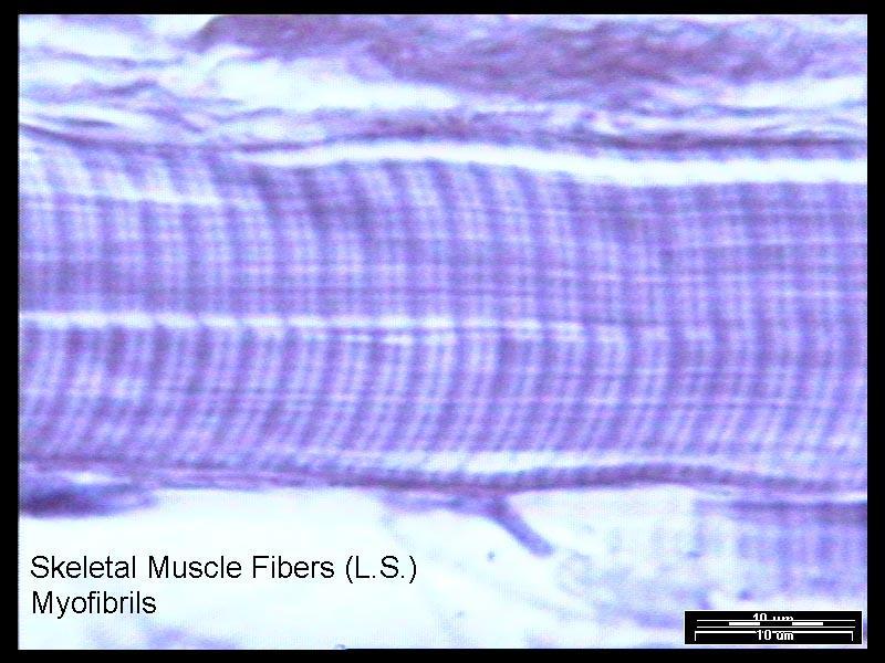 Struktura kosterního svalu Myofibrily se skládají z myofilament