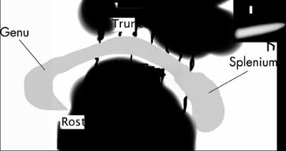 Komisurální dráhy (Fibrae commissurales