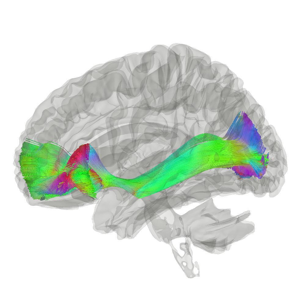 Fasciculus