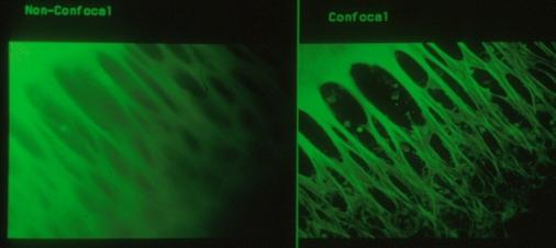 3 Fluorescenční mikroskopie a modelový organismus Fluorescenční mikroskopie klasický kondenzor, ale kondenzor zástinový, který odráží světlo tak, že dopadá na preparát z boku.