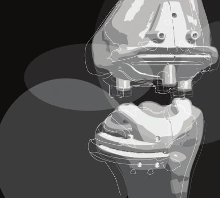 Inzerce VISIONAIRE TECHNOLOGIE S POTENCIÁLEM ZLEPŠIT KLINICKÉ VÝSLEDKY TEP KOLENNÍHO KLOUBU I PROVOZNÍ EFEKTIVITU VÝHODY TECHNOLOGIE VISIONAIRE Méně operačních kroků (přibližně o 20 méně oproti