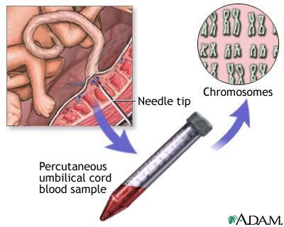 Prenatální vyšetření: c) kultivace buněk pupečníkové krve podobné jako periferní krev odběr krve z kličky pupečníku