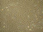 Prenatální vyšetření: a) kultivace buněk plodové vody (buňky odloučené z těla plodu)