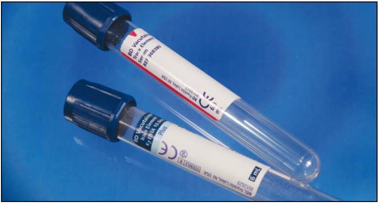 (NMN)), Homocystein, Vitamín B6, Vitamín B1, Vitamín B2 Zkumavka Barva víčka Metody K 2EDTA 368381 BD Vacutainer Plastic K2EDTA tube with Royal Blue BD HemogardTM Closure tmavě modrá na štítku