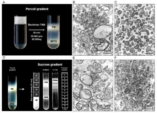 30 Fig. 11 Subcellular fractionation of the rat brain cortex in the absence and presence of high (1% w/v) concentration of non/ionic detergent Triton X 100 From PhD Thesis of Dr.