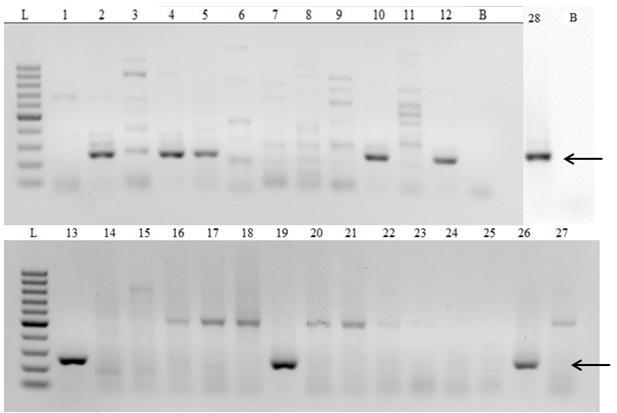 Obrázek 4: Detekce viru šarky švestky (L: GeneRuler 100 bp DNA Ladder, Fermentas; 1 28: jednotlivé vzorky č.
